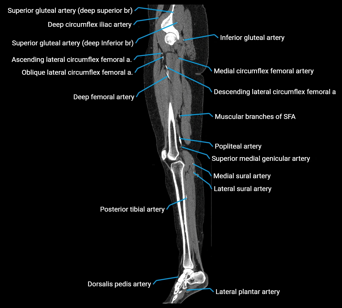 CTA lower limb sagittal cross sectional anatomy labelled image _41 (4).webp